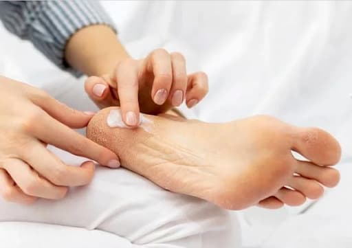 صافی کف پا تا چه سنی قابل درمان است؟
